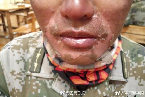 原神暗巷猎手属性是什么